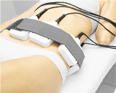 Lipolaser