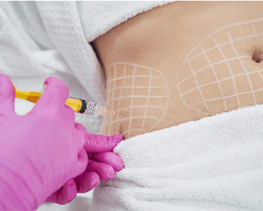 Mesoterapia